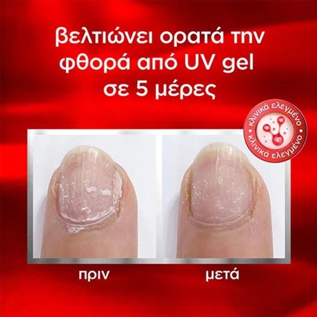 Essie Θεραπεία Νυχιών To the Rescue 13.5ml