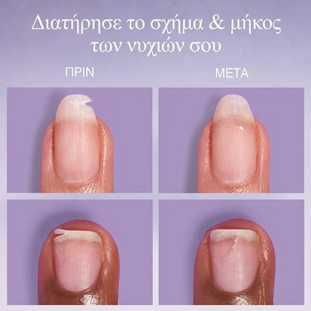 Essie Break Fix Liquid Nail Patch Για Επιδιόρθωση Σπασμένων Νυχιών