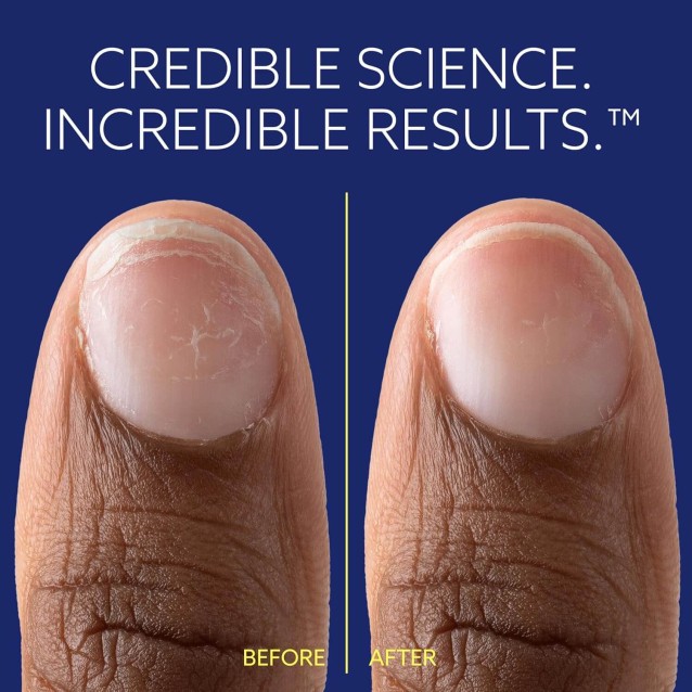 ePhD Bond Repair Θεραπεία Νυχιών Για Άμεση Αναδόμηση  10ml